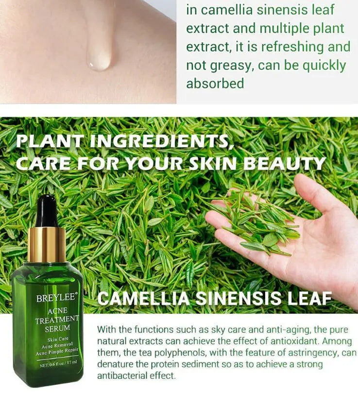 Acne Treatment Serum Facial Repair Oil Breylee