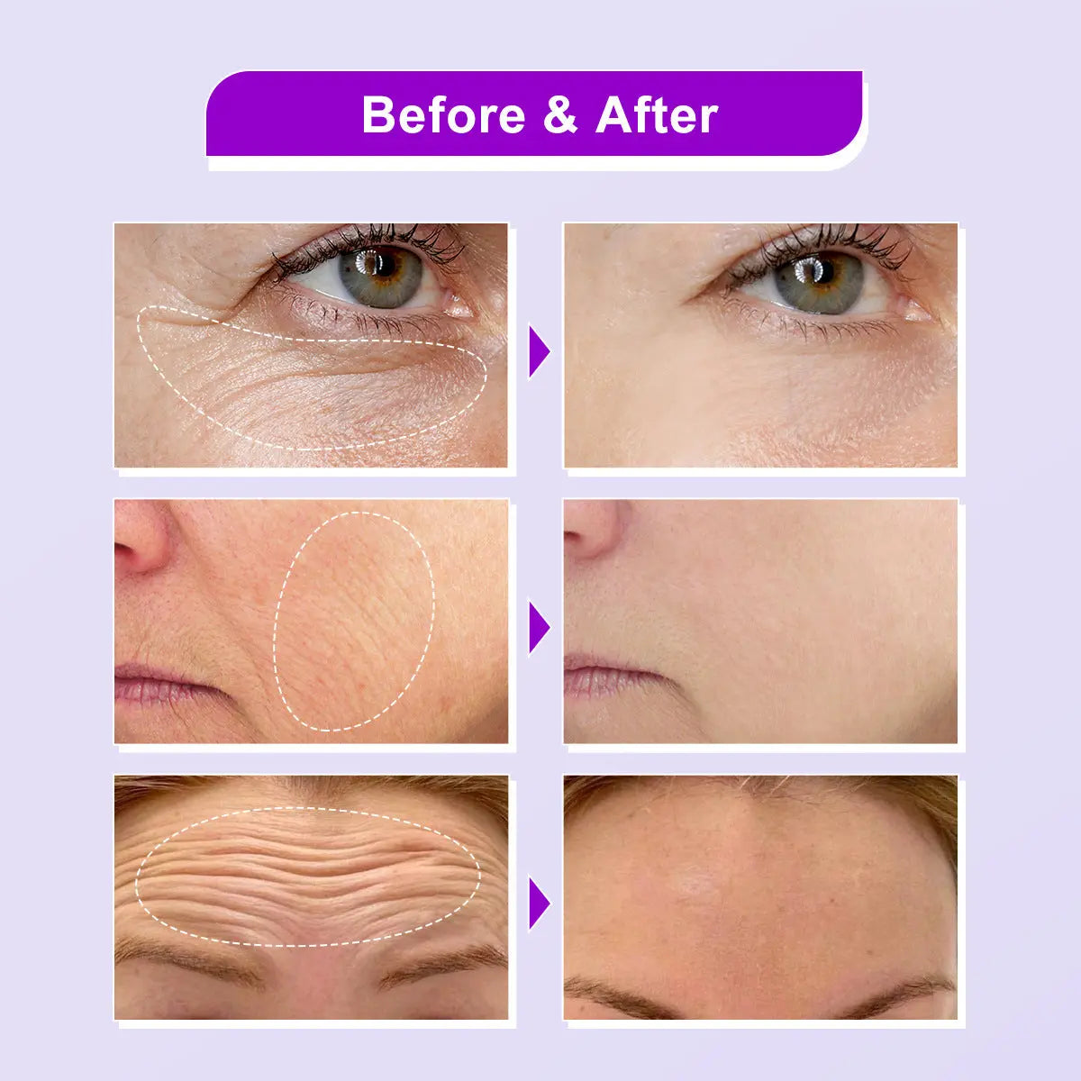 Facial Skin Moisturizing Lotion Soft JoyPrettyin