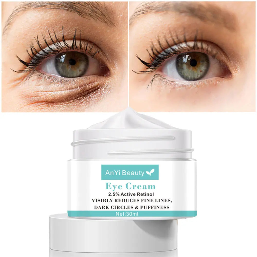 RadiantGlow Eye Revival Cream – 30ml | Ultimate Skin Care for Women AnYi