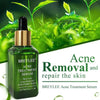Acne Treatment Serum Facial Repair Oil Breylee