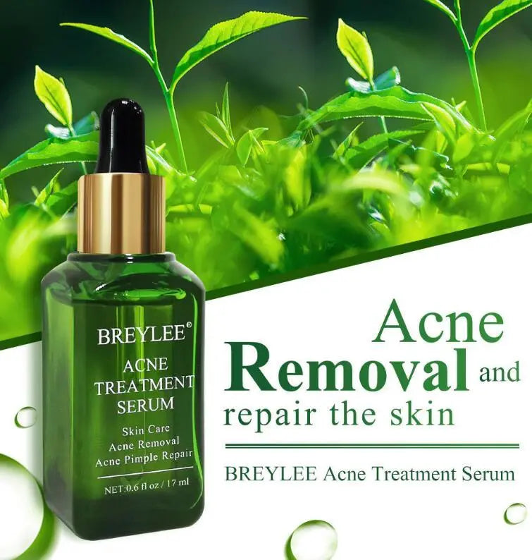 Acne Treatment Serum Facial Repair Oil Breylee