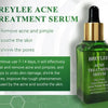 Acne Treatment Serum Facial Repair Oil Breylee