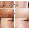 Vitamin C Brightening Face Serum Fusang